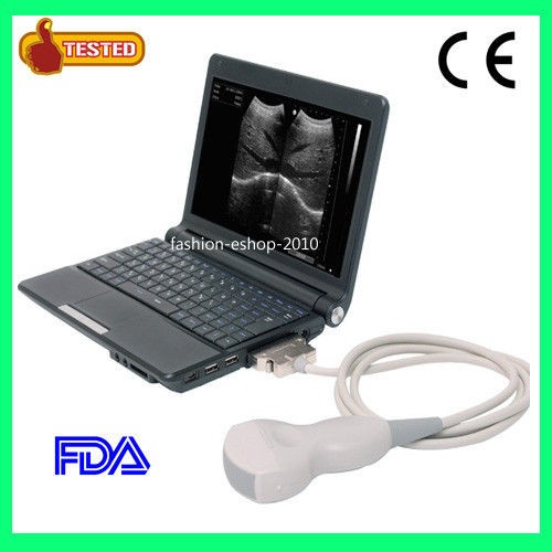   Portable Notebook Laptop Ultrasound machine Scanner system Digital